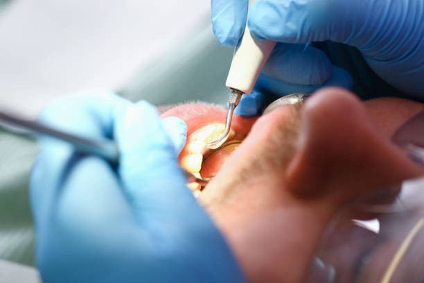 Best Walk-In Emergency Dentist in Centerville, IN
