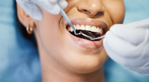 Best Emergency Treatment for Toothache in Centerville, IN