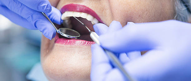 Best Emergency Root Canal Treatment in Centerville, IN