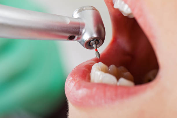 Best Emergency Treatment for Toothache in Centerville, IN